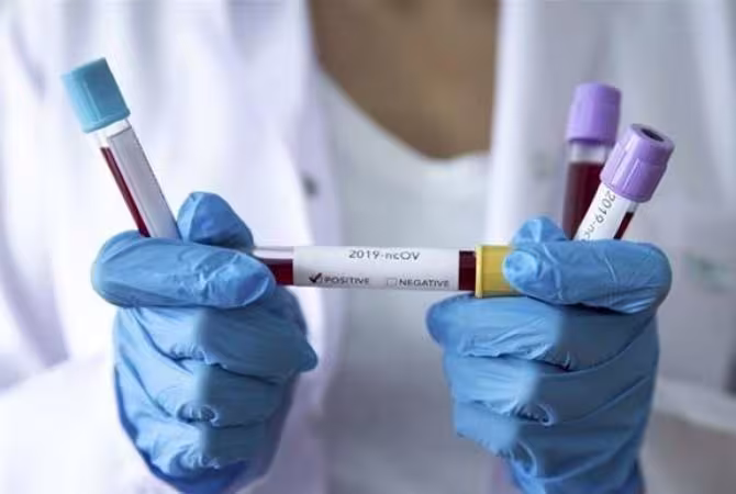 Nouveaux cas de coronavirus en Arménie